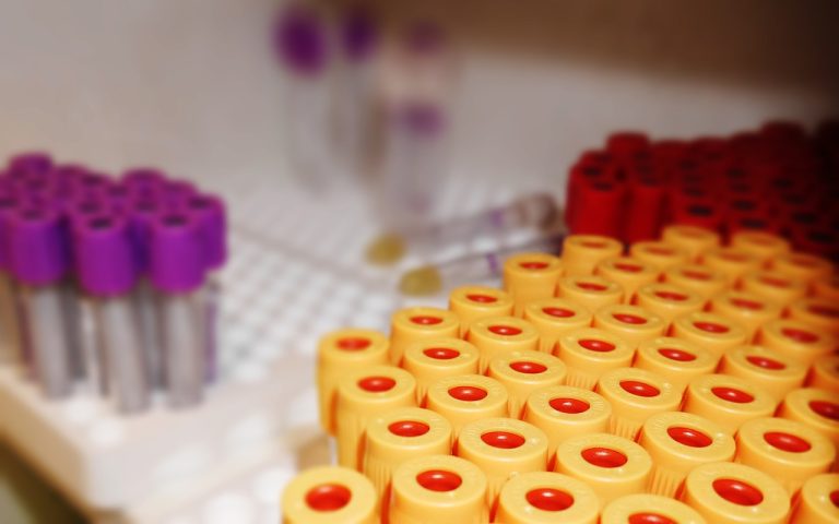 Understanding Blood Collection Tubes: A Comprehensive Guide to Vacutainer Tubes