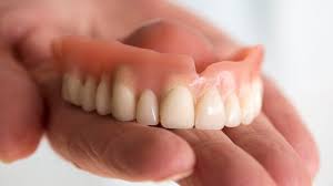 Overdentures: A Comprehensive Guide to Their Importance and Benefits