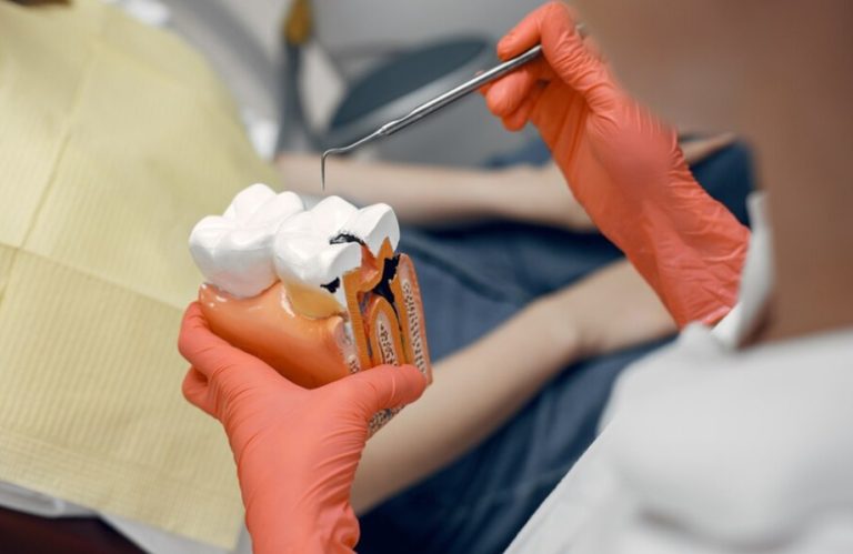 Visit Dentist Kelowna for Hassle-Free Wisdom Tooth Extraction